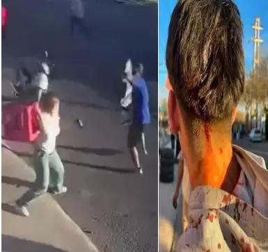 Chimbas: atacaron un kiosco, golpearon a menor y amenazaron con volver